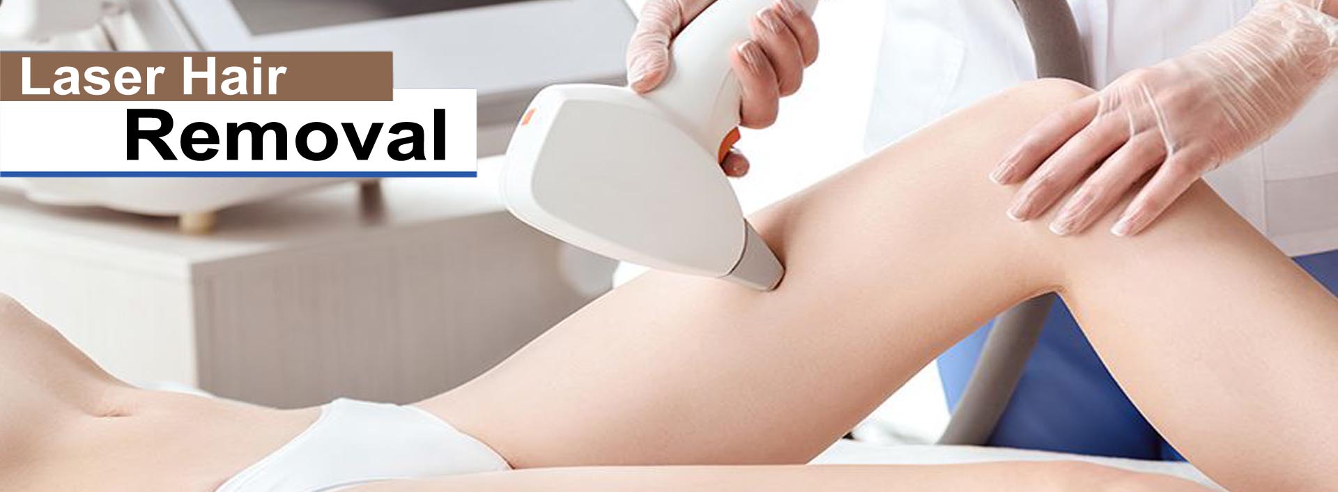 laser-hair-removal